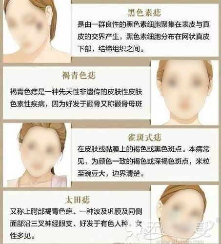 最新方法点痣图片_最新点痣方法_最新方法点痣视频教程