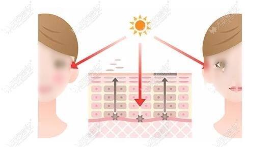 最新方法点痣图片_最新方法点痣视频教程_最新点痣方法