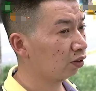 杭州点痣 男子去理发，被人按着手脚消费1万3，理发店：我们是正规收费！