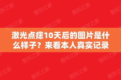 激光点痣10天后的图片是什么样子？来看本人真实记录的点痣过程！过程一点都不恐怖！